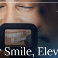 Thinking About Veneers? Here’s a Friendly Introduction