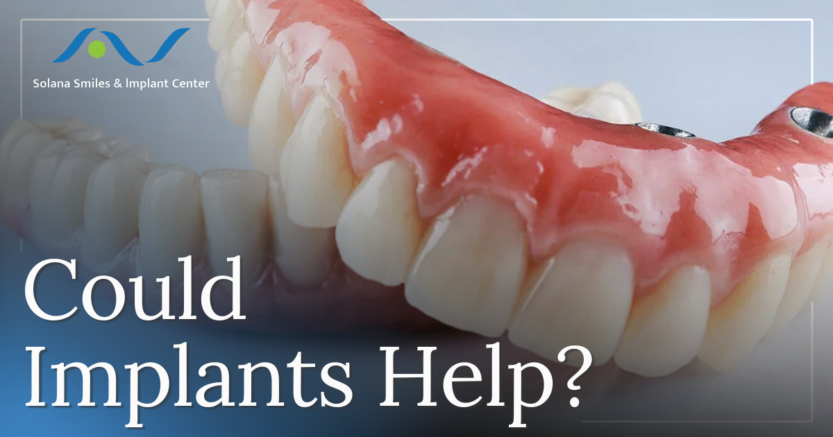 dental implants