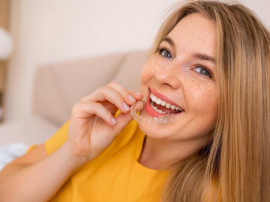 what are clear aligners