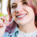 Are Clear Aligners Better Than Braces? What to Know Before You Choose