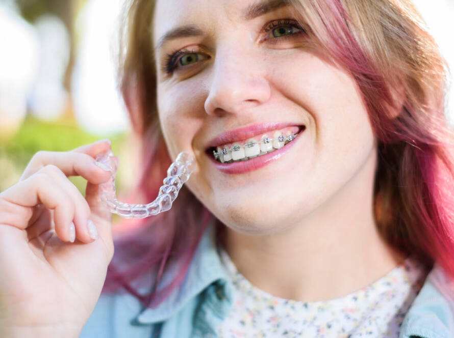 Are Clear Aligners Better Than Braces
