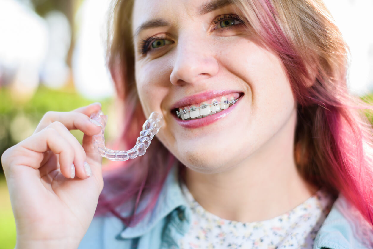 Are Clear Aligners Better Than Braces