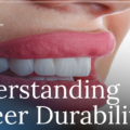 How Long Do Veneers Last?