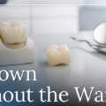 Same-Day Crowns: What Actually Happens During Your Appointment?