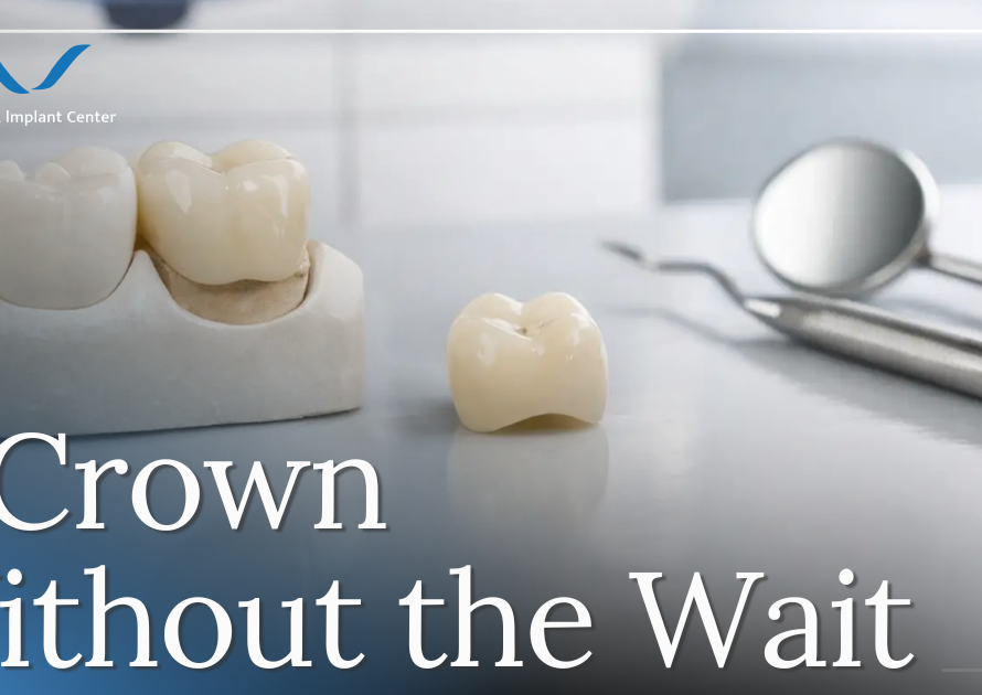 dental crowns
